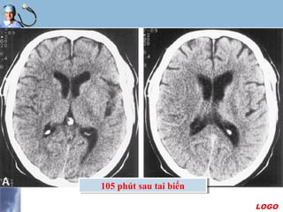 LOGO
105 phút sau tai biến105 phút sau tai biến
 
