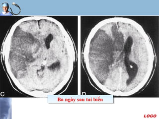 LOGO
Ba ngày sau tai biếnBa ngày sau tai biến
 