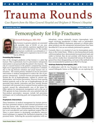 P

A

R

T

N

E

R

S

O

R

T

H

O

P

A

E

D

I

C

Trauma Rounds
Case Reports from the Mass General Hospital and Brigham & Women’s Hospital

A Quarterly Case Study

Volume 5, Fall 2013

Femoroplasty for Hip Fractures
tebroplasty, various minimally invasive femoroplasty techniques involving introduction of ﬁllers such as polymethylHip fractures in geriatric patients are associated methacrylate (PMMA), elastomeric polymers or calcium phoswith mortality rates of 20-30% at one year. phate products into the osteoporotic proximal femur have been
Many more patients experience signiﬁcant loss described (6,7), but are not routinely performed in patients.
of function and independence (1). The number
of hip fractures worldwide was estimated at 1.7 Currently, there is no standard of care for femoroplasty procemillion (1990) and is expected to rise to 6.3 mil- dures in the United States. While in vitro biomechanical results
with femoroplasty have demonstrated increased peak loads and
lion by 2050 (2).
yields to fracture, they do not correlate with fracture prevenPreventing Hip Fractures
tion, and few studies have simulated fall stresses (8). Results in
One of the strongest predictors of hip fracture is a prior hip general have been disappointing, and none of the methods have
fracture. This is particularly true if a preventative osteoporosis been recommended for patient use in the US or Europe.
intervention is not pursued after the patient’s ﬁrst fracture. The Anistropy Restoring Femoroplasty (ARF)
risk of a second fracture in the patient’s uninjured hip remains
high even if appropriate treatment for osteoporosis is initiated, In collaboration with Dr. Ara Nazarian at the Center for Addue to the lag between initiation and actual fracture risk at- vanced Orthopedic Science at the BIDMC, we are exploring the
tenuation. The current primary standard of care for preventive
Retrograde
intervention is medical management to reduce the rate of pro- Figure 1:
ARF in undeployed (top
gressive osteoporosis. Common fracture prevention modalities
left) and deployed (top
include the use of bisphosphonates, vitamin D, calcium sup- right). ARF implanted
plementation, and fracture precautions. However, bone sparing with Ca-Phosphate in
medical protocols such as the use of bisphosphonates do not porcine
model
of
guarantee bone density restoration and have recently become osteoporosis.
associated with increased risk of atypical fracture patterns, particularly around the subtrochanteric area of the femur (3).
Other options for osteoporosis management such as the use of
PTH agonists for bone restoration also carry potential risks (4).
Non-medical preventative measures include fall prevention
techniques, use of cushioning pads and reorganization of living
space.

E Kenneth Rodriguez, MD, PhD

Prophylactic Interventions

These limitations of medical management for fracture prevention have promoted interest in interventional procedures to reduce hip fracture risk. Prophylactic ﬁxation of fractures with
traditional fracture repair instrumentation has been suggested,
but is not cost-effective and carries signiﬁcant surgical risk (5).
There is recent interest in developing cost-effective interventional techniques to augment the mechanical properties of the
proximal femur. Following the successful experience with verTrauma Rounds, Volume 5, Fall 2013

1

 