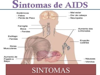 SINTOMAS
 