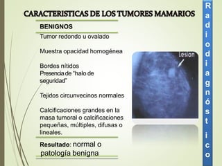 BENIGNOS
Tumor redondo u ovalado
Muestra opacidad homogénea
Bordes nítidos
Presenciade “halo de
seguridad”
Tejidos circunvecinos normales
Calcificaciones grandes en la
masa tumoral o calcificaciones
pequeñas, múltiples, difusas o
lineales.
R
a
d
i
o
d
i
a
g
n
ó
s
t
i
c
o
Resultado: normal o
patología benigna
 
