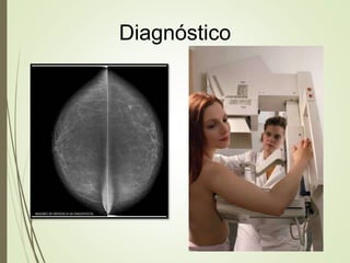 Diagnóstico
 