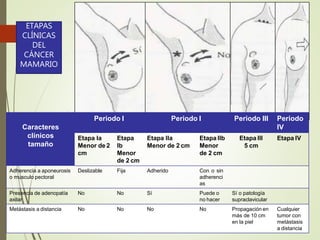 Caracteres
clínicos
tamaño
Periodo I Periodo I Periodo III Periodo
IV
Etapa Ia
Menor de 2
cm
Etapa
Ib
Menor
de 2 cm
Etapa IIa
Menor de 2 cm
Etapa IIb
Menor
de 2 cm
Etapa III
5 cm
Etapa IV
Adherencia a aponeurosis
o musculo pectoral
Deslizable Fija Adherido Con o sin
adherenci
as
Presencia de adenopatía No
axilar
No Sí Puede o
no hacer
Sí o patología
supraclavicular
Metástasis a distancia No No No No Propagación en
más de 10 cm
en la piel
Cualquier
tumor con
metástasis
a distancia
ETAPAS
CLÍNICAS
DEL
CÁNCER
MAMARIO
 