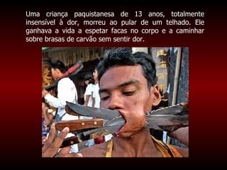 Uma criança paquistanesa de 13 anos, totalmente insensível à dor, morreu ao pular de um telhado. Ele ganhava a vida a espetar facas no corpo e a caminhar sobre brasas de carvão sem sentir dor.  