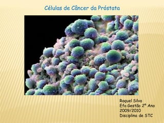 Células de Câncer da Próstata




                            Raquel Silva
                            Efa Gestão 2º Ano
                            2009/2010
                            Disciplina de STC
 