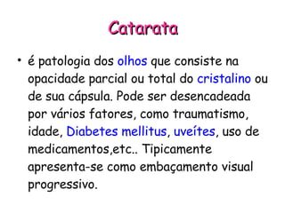 Catarata é patologia dos  olhos  que consiste na opacidade parcial ou total do  cristalino  ou de sua cápsula. Pode ser desencadeada por vários fatores, como traumatismo, idade,  Diabetes mellitus ,  uveítes , uso de medicamentos,etc.. Tipicamente apresenta-se como embaçamento visual progressivo. 