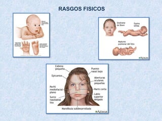 adecuaciones curriculares para estudiantes con sindrome de down