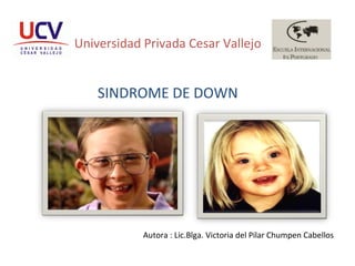 Universidad Privada Cesar Vallejo SINDROME DE DOWN Autora : Lic.Blga. Victoria del Pilar Chumpen Cabellos 