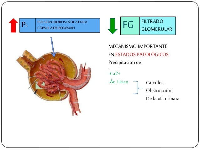 PB PRESIÃNHIDROSTÃTICAENLA CÃPSULADEBOWMAN MECANISMO IMPORTANTE EN ESTADOSPATOLÃGICOS PrecipitaciÃ³n de . -Ca2+ -Ãc. Urico ...
