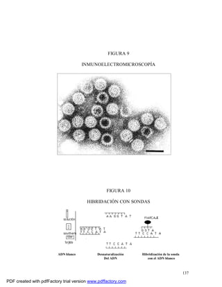 137
FIGURA 9
INMUNOELECTROMICROSCOPÍA
FIGURA 10
HIBRIDACIÓN CON SONDAS
ADN blanco Desnaturalización Hibridización de la sonda
Del ADN con el ADN blanco
PDF created with pdfFactory trial version www.pdffactory.com
 