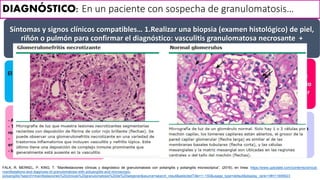 DIAGNÓSTICO: En un paciente con sospecha de granulomatosis…
Síntomas y signos clínicos compatibles… 1.Realizar una biopsia (examen histológico) de piel,
riñón o pulmón para confirmar el diagnóstico: vasculitis granulomatosa necrosante +
2.Prueba positiva para ANCA
El estudio de tejido pulmonar es el que mejores resultados diagnósticos brinda y
casi invariablemente revela vasculitis granulomatosa.
Biopsia de riñón: Presencia de glomerulonefritis pauciinmunitaria
Tiene gran especificidad la positividad
de ANCA contra proteinasa-3 respecto a
granulomatosis de Wegener, en
particular si existe glomerulonefritis
activa. Debe ser un elemento
complementario y no será sustitutivo del
diagnóstico histopatológico
ESTUDIOS DE LABORATORIO:
- ANCA positivo + proteinasa 3-ANCA
- Trombocitosis (> 400,000/microL); como un
reactivo de fase aguda
- Gran incremento de velocidad de
eritrosedimentación (VSG)
- Incrementan niveles de proteína C reactiva
El diagnóstico rápido de
granulomatosis de Wegener es
importante para permitir el inicio
de una terapia que puede salvar
vidas y preservar los órganos.
Anemia normocromática normocítica
- Leucocitosis leve
- Hipergammaglobulinemia poco intensa
(IgA)
- Nivel ligeramente elevado del factor
reumatoide
FALK, R, MERKEL, P, KING, T: “Manifestaciones clínicas y diagnóstico de granulomatosis con poliangitis y poliangitis microscópica”, (2016), en línea: https://www.uptodate.com/contents/clinical-
manifestations-and-diagnosis-of-granulomatosis-with-polyangiitis-and-microscopic-
polyangiitis?search=manifestaciones%20clinicas%20granulomatosis%20de%20wegener&source=search_result&selectedTitle=1~150&usage_type=default&display_rank=1#H11699923
 