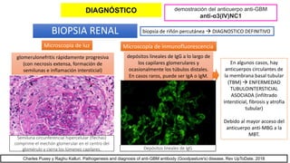 BIOPSIA RENAL biopsia de riñón percutánea  DIAGNOSTICO DEFINITIVO
depósitos lineales de IgG a lo largo de
los capilares glomerulares y
ocasionalmente los túbulos distales.
En casos raros, puede ser IgA o IgM.
En algunos casos, hay
anticuerpos circulantes de
la membrana basal tubular
(TBM)  ENFERMEDAD
TUBULOINTERSTICIAL
ASOCIADA (infiltrado
intersticial, fibrosis y atrofia
tubular)
Debido al mayor acceso del
anticuerpo anti-MBG a la
MBT.
Microscopía de luz Microscopía de inmunofluorescencia
glomerulonefritis rápidamente progresiva
(con necrosis extensa, formación de
semilunas e inflamación intersticial)
Semiluna circunferencial hipercelular (flechas)
comprime el mechón glomerular en el centro del
glomérulo y cierra los lúmenes capilares. Depósitos lineales de IgG
demostración del anticuerpo anti-GBM
anti-α3(IV)NC1
Charles Pusey y Raghu Kalluri. Pathogenesis and diagnosis of anti-GBM antibody (Goodpasture's) disease. Rev UpToDate. 2018
DIAGNÓSTICO
 
