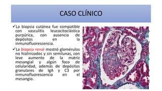 CASO CLÍNICO
Urea y creatinina normales
Velocidad de sedimentación
globular de 95mm/h
Proteína C reactiva de 5,8mg/dl
Microhematuria
Proteínas de 2.859mg en orina
de 24h
Complemento normal e IgA
elevada.
Los autoanticuerpos fueron
negativos.
La serología de VHB fue
compatible con infección crónica
con carga viral negativa.
El factor reumatoide fue positivo
a título bajo y se interpretó como
secundario a la infección por el
VHB.
EXÁMENES AUXILIARESLa biopsia cutánea fue compatible
con vasculitis leucocitoclástica
purpúrica, con ausencia de
depósitos en la
inmunofluorescencia.
La biopsia renal mostró glomérulos
no hialinizados y sin semilunas, con
leve aumento de la matriz
mesangial y algún foco de
celularidad, además de depósitos
granulares de IgA y C3 por
inmunofluorescencia en el
mesangio.
 