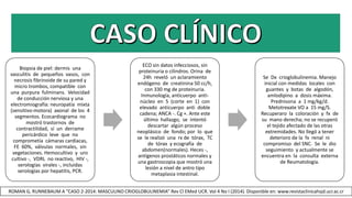 Biopsia de piel: dermis una
vasculitis de pequeños vasos, con
necrosis fibrinoide de su pared y
micro trombos, compatible con
una purpura fulminans. Velocidad
de conducción nerviosa y una
electromiografía: neuropatía mixta
(sensitivo-motora) axonal de los 4
segmentos. Ecocardiograma no
mostró trastornos de
contractilidad, sí un derrame
pericárdico leve que no
comprometía cámaras cardiacas,
FE 60%, válvulas normales, sin
vegetaciones. Hemocultivo y uro
cultivo -, VDRL no reactivo, HIV -,
serologías virales -, incluidas
serologías por hepatitis, PCR.
ECO sin datos infecciosos, sin
proteinuria o cilindros. Orina de
24h reveló un aclaramiento
endógeno de creatinina 50 cc/h,
con 330 mg de proteinuria.
Inmunología, anticuerpo anti-
núcleo en 5 (corte en 1) con
elevado anticuerpo anti doble
cadena; ANCA -. Cg +. Ante este
último hallazgo, se intentó
descartar algún proceso
neoplásico de fondo; por lo que
se le realizó una rx de tórax, TC
de tórax y ecografía de
abdomen(normales). Heces -,
antígenos prostáticos normales y
una gastroscopia que mostró una
lesión a nivel de antro tipo
metaplasia intestinal.
Se Dx crioglobulinemia. Manejo
inicial con medidas locales con
guantes y botas de algodón,
amlodipino a dosis máxima.
Prednisona a 1 mg/kg/d.
Metotrexate VO a 15 mg/S.
Recuperaro la coloración y fx de
su mano derecha; no se recuperó
el tejido afectado de las otras
extremidades. No llegó a tener
deterioro de la fx renal ni
compromiso del SNC. Se le dio
seguimiento y actualmente se
encuentra en la consulta externa
de Reumatología.
ROMAN G, RUNNEBAUM A “CASO 2-2014: MASCULINO CRIOGLOBULINEMIA” Rev Cl EMed UCR. Vol 4 No I (2014). Disponible en: www.revistaclinicahsjd.ucr.ac.cr
 