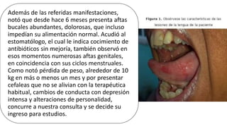 Además de las referidas manifestaciones,
notó que desde hace 6 meses presenta aftas
bucales abundantes, dolorosas, que incluso
impedían su alimentación normal. Acudió al
estomatólogo, el cual le indica cocimiento de
antibióticos sin mejoría, también observó en
esos momentos numerosas aftas genitales,
en coincidencia con sus ciclos menstruales.
Como notó pérdida de peso, alrededor de 10
kg en más o menos un mes y por presentar
cefaleas que no se alivian con la terapéutica
habitual, cambios de conducta con depresión
intensa y alteraciones de personalidad,
concurre a nuestra consulta y se decide su
ingreso para estudios.
 