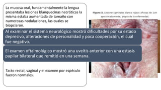 La mucosa oral, fundamentalmente la lengua
presentaba lesiones blanquecinas necróticas la
misma estaba aumentada de tamaño con
numerosas nodulaciones, las cuales se
biopciaron.
En los genitales se observaron de 6 a 7 úlceras
dolorosas de aproximadamente 3mm,
blanquecinas, necróticas con bordes
eritematosos.
Tacto rectal, vaginal y el examen por espéculo
fueron normales.
Al examinar el sistema neurológico mostró dificultades por su estado
depresivo, alteraciones de personalidad y poca cooperación, el cual
fue negativo.
El examen oftalmológico mostró una uveítis anterior con una estasis
papilar bilateral que remitió en una semana.
 