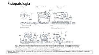 Fisiopatología
Fuente: Xiao H, Hu P, Falk RJ, Jennette JC. Overview of the Pathogenesis of ANCA-Associated Vasculitis. Kidney Dis (Basel). marzo de
2016;1(4):205-15.
 