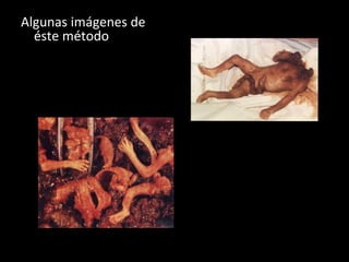 Algunas imágenes de éste método 