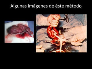 Algunas imágenes de éste método 