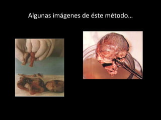 Algunas imágenes de éste método… 