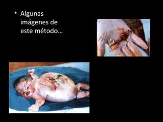 Algunas imágenes de este método… 