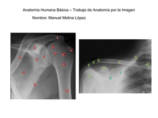 Anatomía Humana Básica – Trabajo de Anatomía por la Imagen
Nombre: Manuel Molina López
1
3
2
4
6
7
5
11
8
9 10
12
13
A
B
C
D
E
F
G
H
K
J
I
 