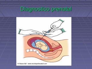 Diagnostico prenatalDiagnostico prenatal
 