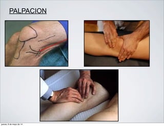 PALPACION
jueves, 8 de mayo de 14
 