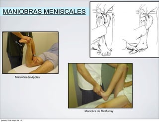 MANIOBRAS MENISCALES
Maniobra de Appley
Maniobra de McMurray
jueves, 8 de mayo de 14
 