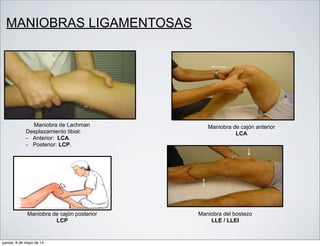 MANIOBRAS LIGAMENTOSAS
Maniobra de Lachman
Desplazamiento tibial:
- Anterior: LCA.
- Posterior: LCP.
Maniobra de cajón anterior
LCA
Maniobra de cajón posterior
LCP
Maniobra del bostezo
LLE / LLEI
jueves, 8 de mayo de 14
 