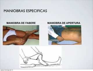 MANIOBRA DE FABERE MANIOBRA DE APERTURA
MANIOBRAS ESPECIFICAS
jueves, 8 de mayo de 14
 