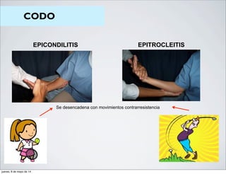 CODO
EPICONDILITIS EPITROCLEITIS
Se desencadena con movimientos contrarresistencia
jueves, 8 de mayo de 14
 