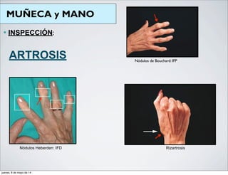 MUÑECA y MANO
— INSPECCIÓN:
ARTROSIS
Rizartrosis
Nódulos de Bouchard: IFP
Nódulos Heberden: IFD
jueves, 8 de mayo de 14
 