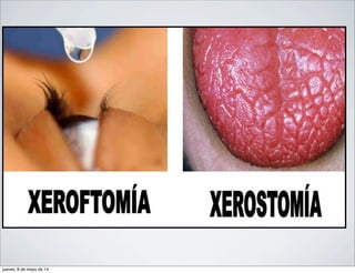 jueves, 8 de mayo de 14
 