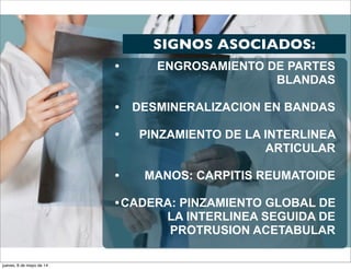SIGNOS ASOCIADOS:
• ENGROSAMIENTO DE PARTES
BLANDAS
• DESMINERALIZACION EN BANDAS
• PINZAMIENTO DE LA INTERLINEA
ARTICULAR
• MANOS: CARPITIS REUMATOIDE
•CADERA: PINZAMIENTO GLOBAL DE
LA INTERLINEA SEGUIDA DE
PROTRUSION ACETABULAR
jueves, 8 de mayo de 14
 