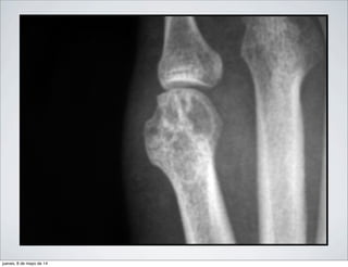 jueves, 8 de mayo de 14
 