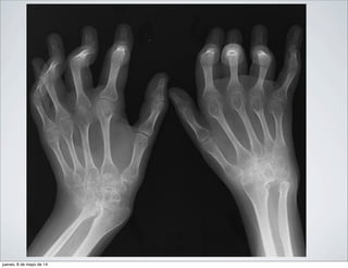 jueves, 8 de mayo de 14
 