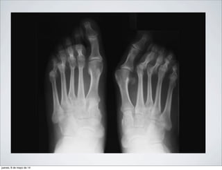 jueves, 8 de mayo de 14
 