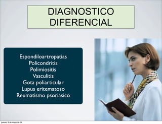 Espondiloartropatias
Policondritis
Polimiositis
Vasculitis
Gota poliarticular
Lupus eritematoso
Reumatismo psoriasico
DIAGNOSTICO
DIFERENCIAL
jueves, 8 de mayo de 14
 