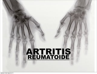 ARTRITIS
REUMATOIDE
jueves, 8 de mayo de 14
 