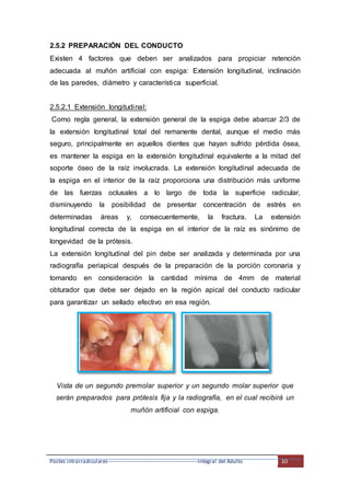 Postes intrarradiculares---------------------------------------------------Integral del Adulto 10
2.5.2 PREPARACIÓN DEL CONDUCTO
Existen 4 factores que deben ser analizados para propiciar retención
adecuada al muñón artificial con espiga: Extensión longitudinal, inclinación
de las paredes, diámetro y característica superficial.
2.5.2.1 Extensión longitudinal:
Como regla general, la extensión general de la espiga debe abarcar 2/3 de
la extensión longitudinal total del remanente dental, aunque el medio más
seguro, principalmente en aquellos dientes que hayan sufrido pérdida ósea,
es mantener la espiga en la extensión longitudinal equivalente a la mitad del
soporte óseo de la raíz involucrada. La extensión longitudinal adecuada de
la espiga en el interior de la raíz proporciona una distribución más uniforme
de las fuerzas oclusales a lo largo de toda la superficie radicular,
disminuyendo la posibilidad de presentar concentración de estrés en
determinadas áreas y, consecuentemente, la fractura. La extensión
longitudinal correcta de la espiga en el interior de la raíz es sinónimo de
longevidad de la prótesis.
La extensión longitudinal del pin debe ser analizada y determinada por una
radiografía periapical después de la preparación de la porción coronaria y
tomando en consideración la cantidad mínima de 4mm de material
obturador que debe ser dejado en la región apical del conducto radicular
para garantizar un sellado efectivo en esa región.
Vista de un segundo premolar superior y un segundo molar superior que
serán preparados para prótesis fija y la radiografía, en el cual recibirá un
muñón artificial con espiga.
 