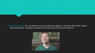 3. Síndrome de Down: Es una anomalía cromo somática que afecta a 1 de cada 1000 recién nacidos
aproximadamente. Consiste en la aparición de una copia extra del cromosoma 21.
 