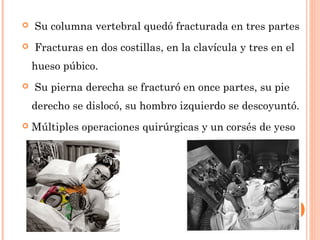 

 Su columna vertebral quedó fracturada en tres partes



 Fracturas en dos costillas, en la clavícula y tres en el
hueso púbico.



 Su pierna derecha se fracturó en once partes, su pie
derecho se dislocó, su hombro izquierdo se descoyuntó.



Múltiples operaciones quirúrgicas y un corsés de yeso 

 