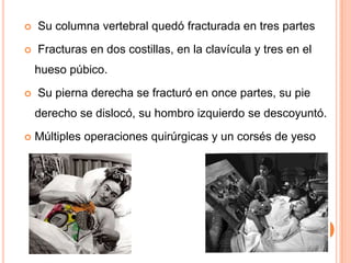

Su columna vertebral quedó fracturada en tres partes



Fracturas en dos costillas, en la clavícula y tres en el
hueso púbico.



Su pierna derecha se fracturó en once partes, su pie

derecho se dislocó, su hombro izquierdo se descoyuntó.


Múltiples operaciones quirúrgicas y un corsés de yeso

 