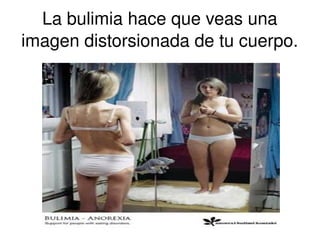 La bulimia hace que veas una 
imagen distorsionada de tu cuerpo. 
 