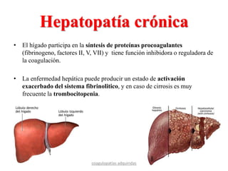 Hepatopatía crónica
• El hígado participa en la síntesis de proteínas procoagulantes
(fibrinogeno, factores II, V, VII) y tiene función inhibidora o reguladora de
la coagulación.
• La enfermedad hepática puede producir un estado de activación
exacerbado del sistema fibrinolitico, y en caso de cirrosis es muy
frecuente la trombocitopenia.
coagulopatías adquiridas
 