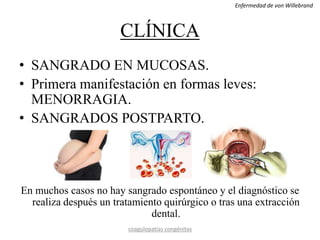 CLÍNICA
• SANGRADO EN MUCOSAS.
• Primera manifestación en formas leves:
MENORRAGIA.
• SANGRADOS POSTPARTO.
En muchos casos no hay sangrado espontáneo y el diagnóstico se
realiza después un tratamiento quirúrgico o tras una extracción
dental.
coagulopatías congénitas
Enfermedad de von Willebrand
 