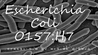 Escherichia
Coli
O157:H7
 