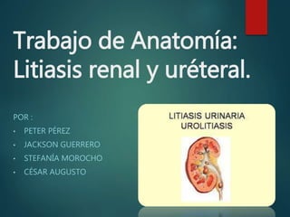 Trabajo de Anatomía:
Litiasis renal y uréteral.
POR :
• PETER PÉREZ
• JACKSON GUERRERO
• STEFANÍA MOROCHO
• CÉSAR AUGUSTO
 