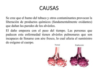 Bajos niveles de sodio
